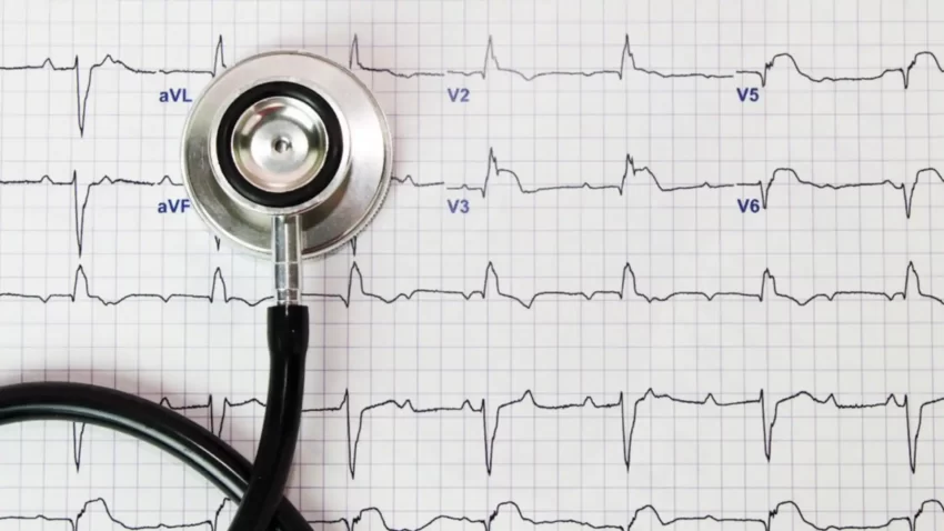 EKG Nedir? EKG Nasıl Çekilir?